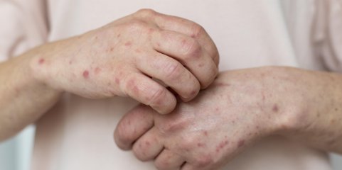 Neandertais foram primeiras &#039;vítimas&#039; humanas de percevejos há 60 mil anos - Estudo