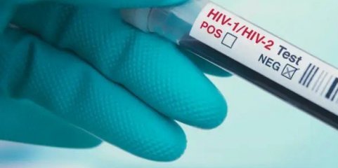 Autoridades de saúde dos Estados Unidos aprovam primeira vacina contra VIH-SIDA
