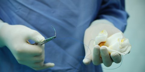 Novo sistema vai impedir que médicos escolham as cirurgias adicionais – diretor SNS