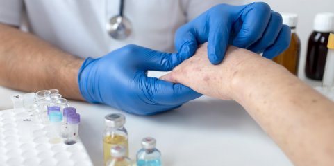 Mpox: África precisa de 3,4 milhões de vacinas para combater surtos - UA