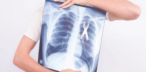 ULS Santo António e Cascais avançam com rastreio ao cancro do pulmão