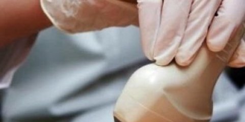 Unilabs sem vagas para ecografias mamárias e à tiróide pelo SNS em seis distritos