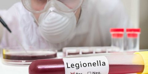 Complexo de piscinas de Folgosa na Maia encerrado por suspeitas de ‘legionella’
