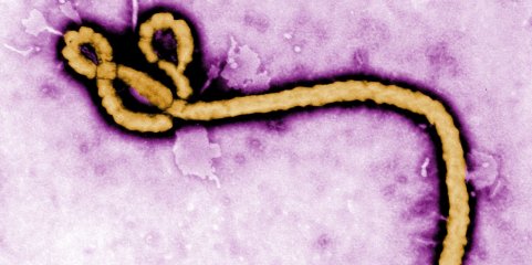 Ébola: OMS envia doze toneladas de material médico para a RDCongo