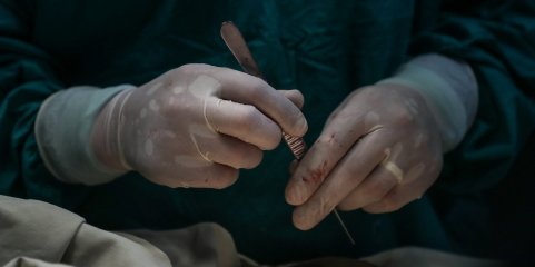 Americano que recebeu transplante de rim de porco está a recuperar bem da operação realizada em junho