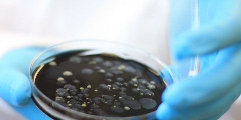 Detetada &#039;legionella&#039; em lar de idosos de Lagos sem registo de infetados - instituição