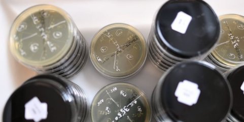 Detetada &#039;legionella&#039; em duas escolas do concelho de Paredes
