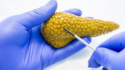 Incidência do cancro do pâncreas cresce mas investigação já permite curas iniciais