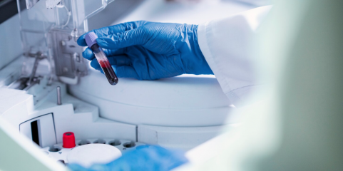 Gasto do Estado em análises clínicas sobe e atinge 244 milhões em 2024