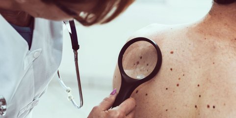 Peritos identificaram neoplasias benignas pagas como malignas em Santa Maria