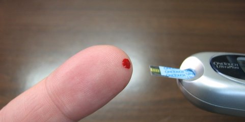 Diabetes nos Açores acima dos valores nacionais com taxa de 17%