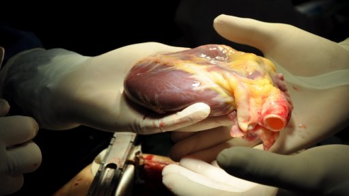 ULS Gaia/Espinho prepara-se para realizar transplante cardíaco no prazo de um ano