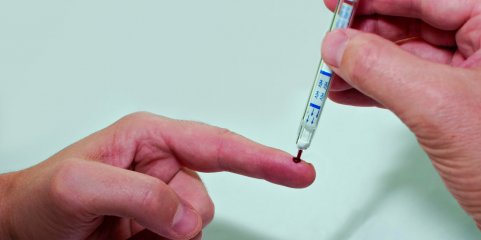 Menos casos de VIH em Portugal em 2024, mas maioria dos diagnósticos foi tardia