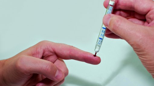 Menos casos de VIH em Portugal em 2024, mas maioria dos diagnósticos foi tardia