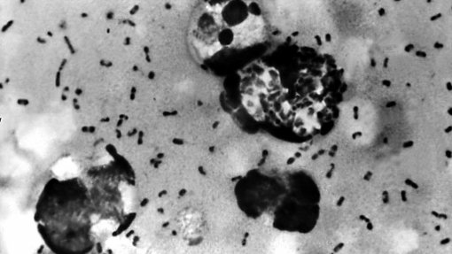 Erupção vulcânica desencadeou efeito dominó que provocou Peste Negra na Europa - Estudo