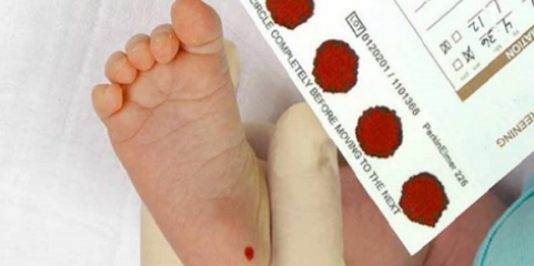 &quot;Doença dos pezinhos&quot; afeta duas centenas de pessoas no distrito de Aveiro