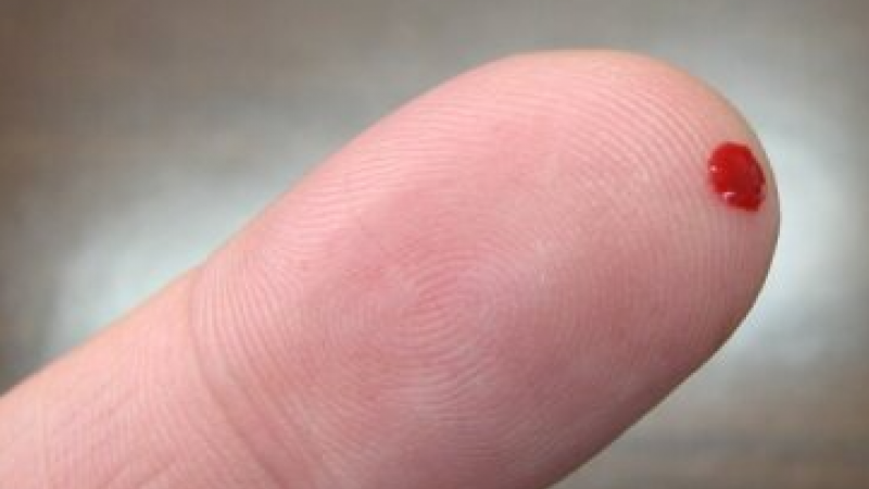 Gota de sangue da ponta do dedo pode detetar Alzheimer - Estudo
