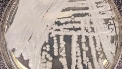 Infeções por Candida auris confirmadas em hospitais públicos entre 2022 e 2025 - INSA