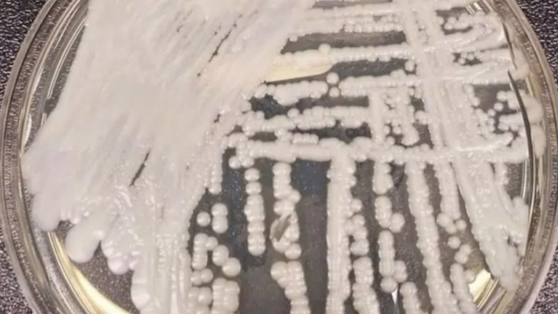 Infeções por Candida auris confirmadas em hospitais públicos entre 2022 e 2025 - INSA