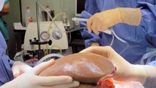 Homem doa dois órgãos à filha no primeiro transplante combinado de dador vivo em Itália