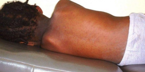 Moçambique com mais de 600 casos de sarampo e um morto em surto com seis meses