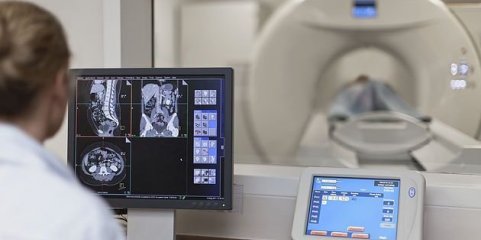 SNS paga valores 50% inferiores aos da ADSE aos convencionados de radiologia - associação