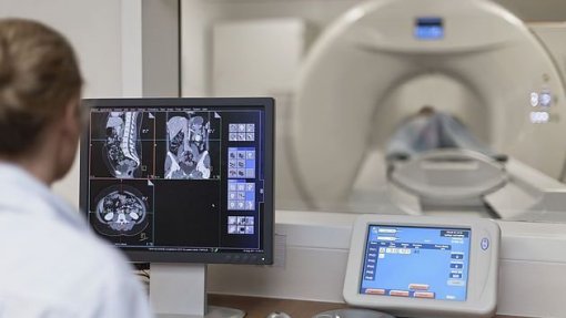 SNS paga valores 50% inferiores aos da ADSE aos convencionados de radiologia - associação