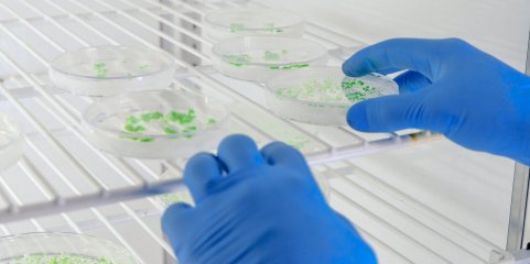 Estudo revela novos fatores para virulência de bactéria multirresistente