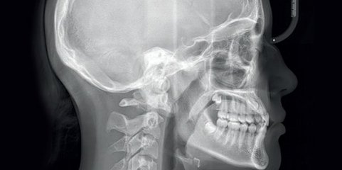 Cientistas russos descobrem cirurgia maxilofacial realizada há 2500 anos