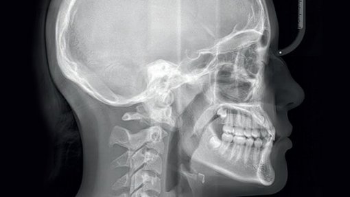 Cientistas russos descobrem cirurgia maxilofacial realizada há 2500 anos
