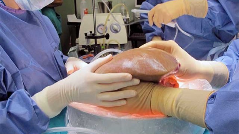 Médio Tejo aumentou em 2025 número de órgãos colhidos para transplantação