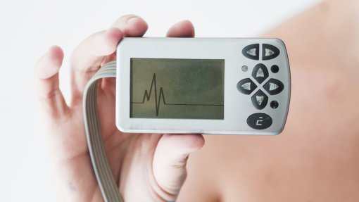 ULS da Região de Leiria fez primeiro implante de ‘pacemaker’ sem elétrodos