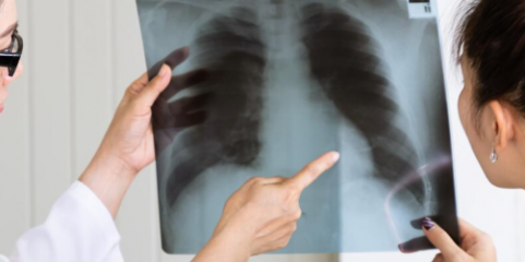 Taxa de mortalidade por tuberculose em Angola baixou para quase metade em 2025