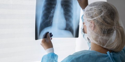 Mais de 17 mil pessoas sem diagnóstico da tuberculose por ano em Moçambique - ONG