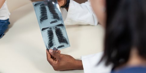 Liga Portuguesa Contra a Sida identifica 54 casos de tuberculose em 2.511 rastreios