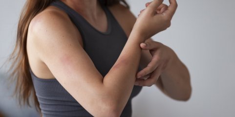 Investigação em Leiria quer ajudar no diagnóstico de lesões cancerígenas na pele