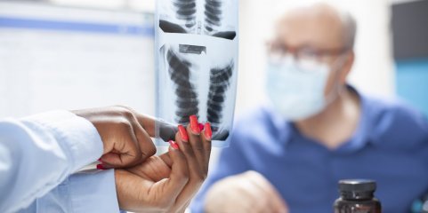 Moçambique reduz mortes por tuberculose mas doença ainda mata 14 mil por ano