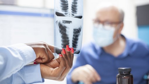 Moçambique reduz mortes por tuberculose mas doença ainda mata 14 mil por ano