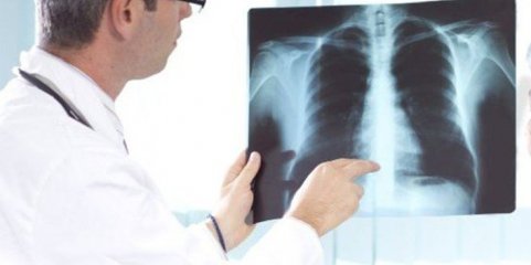 Projetos-piloto de rastreio do cancro do pulmão arrancam nas ULS Gaia/Espinho e Santa Maria