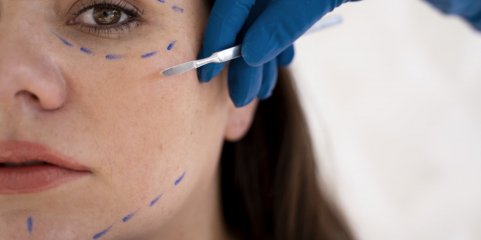 Cerca de 1.000 denúncias de procedimentos estéticos por pessoas não habilitadas em nove anos