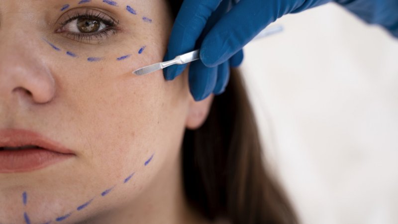 Cerca de 1.000 denúncias de procedimentos estéticos por pessoas não habilitadas em nove anos