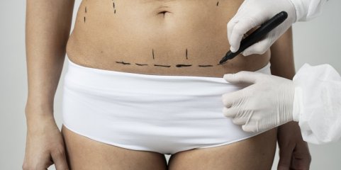 Regulador mandou suspender atividade em 19 estabelecimentos de saúde ligados à estética