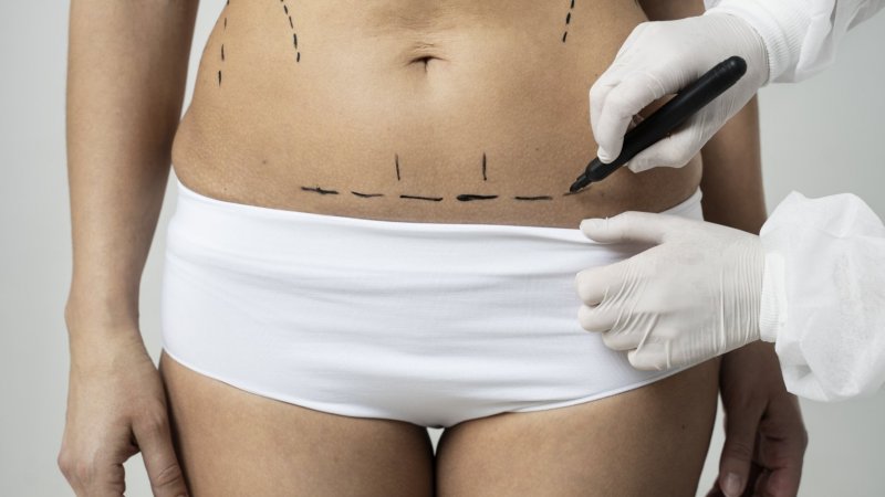 Regulador mandou suspender atividade em 19 estabelecimentos de saúde ligados à estética