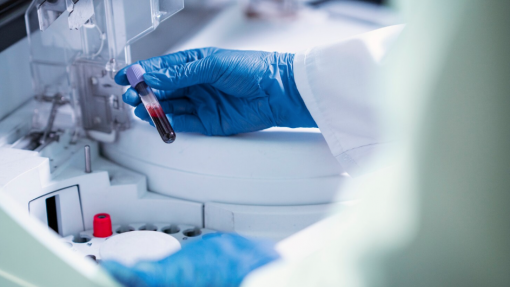 Associação pede anulação de concurso da ULS Lisboa Ocidental para colheitas de análises clínicas