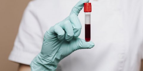 Técnico de sangue detido pela PJ foi proibido de entrar em Coimbra pelo tribunal