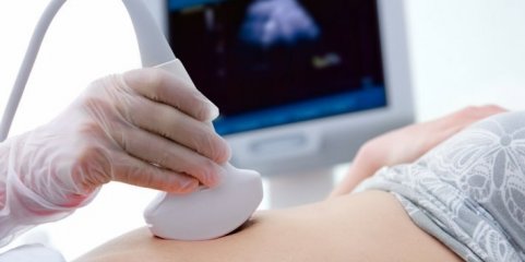 Interrupções da gravidez aumentam 5% em 2024 e ultrapassam as 18 mil - DGS