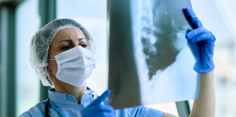 Estudo identifica “terapêutica promissora” para fibrose pulmonar idiopática