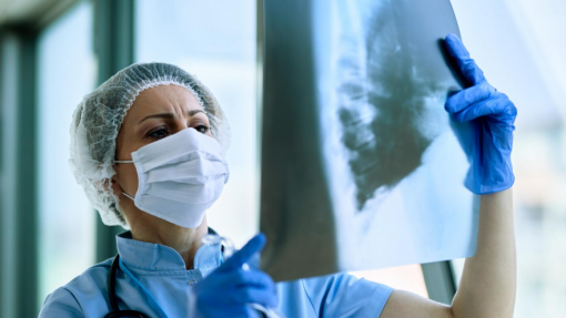 Estudo identifica “terapêutica promissora” para fibrose pulmonar idiopática