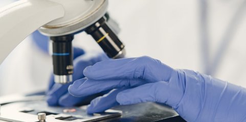 Identificadas duas proteínas-chave na defesa das células tumorais contra a radioterapia