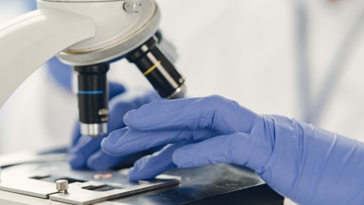 Identificadas duas proteínas-chave na defesa das células tumorais contra a radioterapia